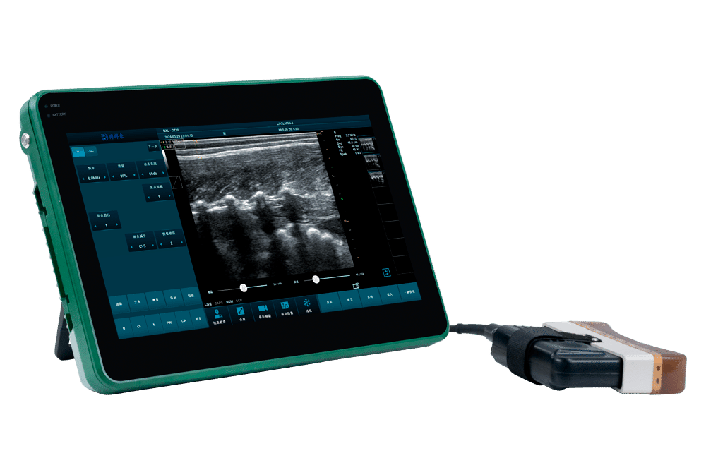 BXL-DZ20 Multifunctional Livestock Backfat & Eye Muscle Ultrasound Scanner