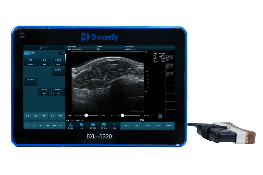 BXL-DB20 Pigs Cattle Sheeps Backfat Ultrasound Device | Breeding-Specific Equipment
