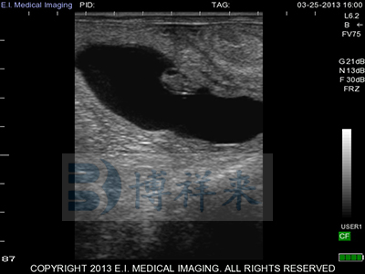 Accurately Detecting Cow Pregnancy Using Ultrasound Scans