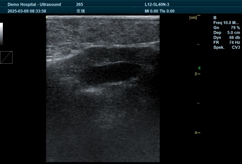 Fish Ultrasound Images What Can Veterinary Ultrasound Machines Detect?