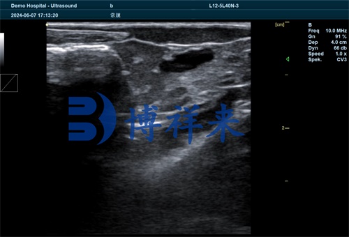 Intravascular Ultrasound in Small Animal Diagnostics