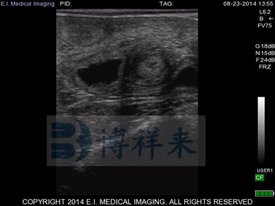 How Early Can You Ultrasound Cattle?