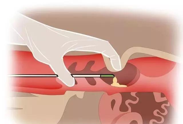 How Soon Can You Scan a Cow for Pregnancy?