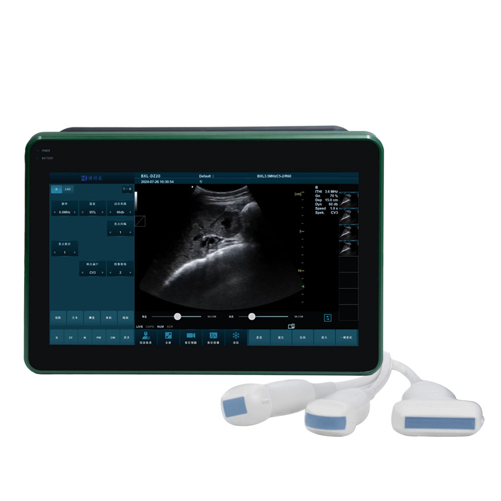 BXL-DZ20 Advanced Veterinary Ultrasound Machine – Portable, Waterproof, Multi-Species