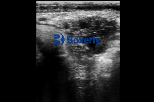 Can Ultrasound Exams in Cows Cause Miscarriage or Abortion?