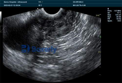 Using Portable Ultrasound to Assess Ovarian Activity in Sheep