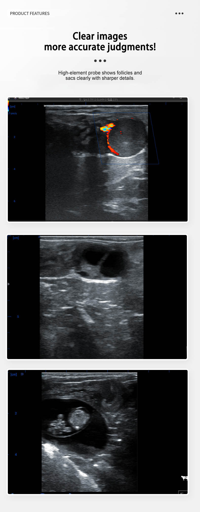 BXL-S300 Doppler Cattle & Horse Pregnancy Scanner, 128-Sondar, S200 Upgrade