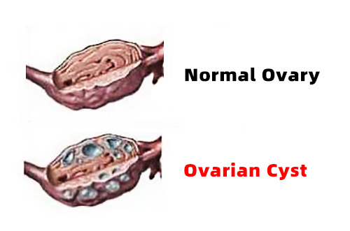 How Can Farmers Detect Ovarian Cysts in Dairy Cows Early?